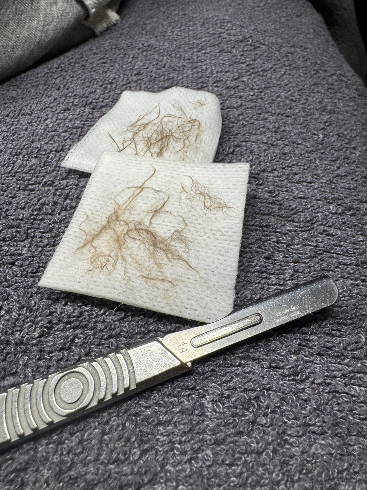 Professional hair removal results at Royal Glow Beauty & Esthetics in Boardman, Ohio